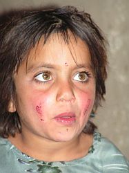 von Armut gezeichnetes Kind aus Kabul