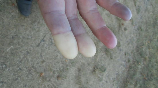 Die Abkühlung muß wohl ausreichend gewesen sein.