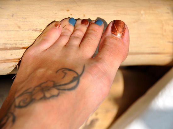 NACH der Pediküre - das VORHER-Bild ersparen wir der Öffentlichkeit.