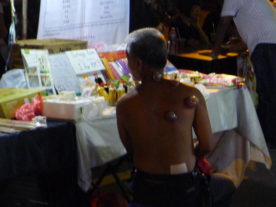 Wahrer Körpereinsatz: der "geschulte" Verkäufer diversen Gesundheitszubehörs demonstriert das Schröpfen an sich selbst