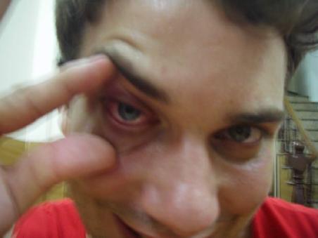 Arrrr!!! RedEye
(Ohne FingerHilfe war das Ding einfach nicht aufzukriegen)