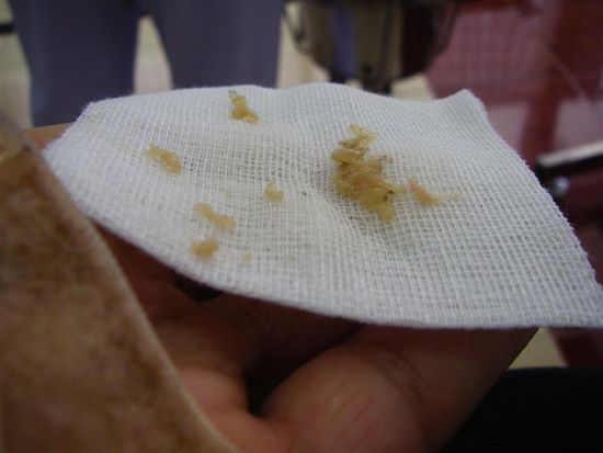 Faules-Fleisch-Erntedankfest