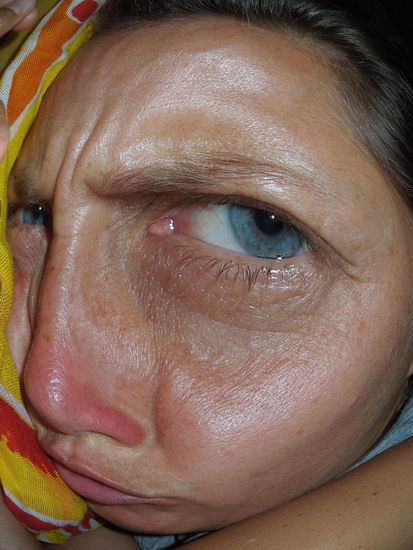 Von mehr als 30 roten Punkten pro Person sind wir gar nicht begeistert!!!