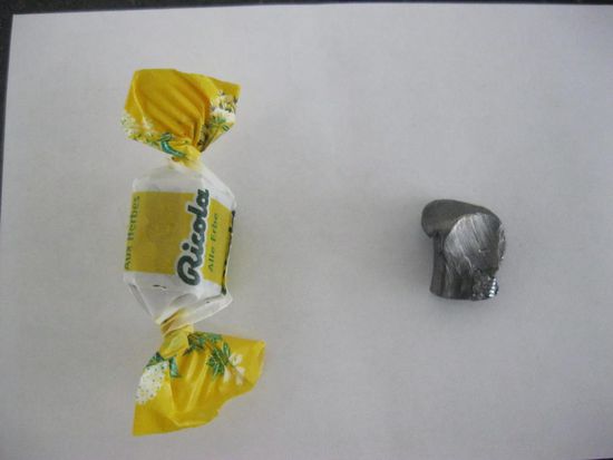 Das herausoperierte Projektil im Größenvergleich.