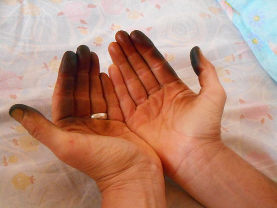 Meine Hände nach der Arbeit - schwarz gefärbt