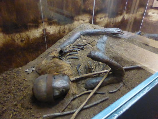 Das Windeby-Mädchen