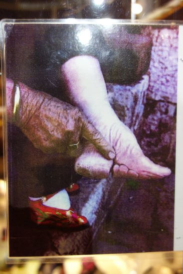 so wurden die Füße maltraitiert, damit die Schuhe getragen werden konnten