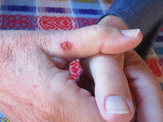 ... mit entsprechendem Resultat ...