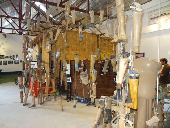 Einige der zahlreichen selbstgebauten oder sich nicht mehr in Verwendung befindlichen Prothesen, die gegen Neue getauscht wurden