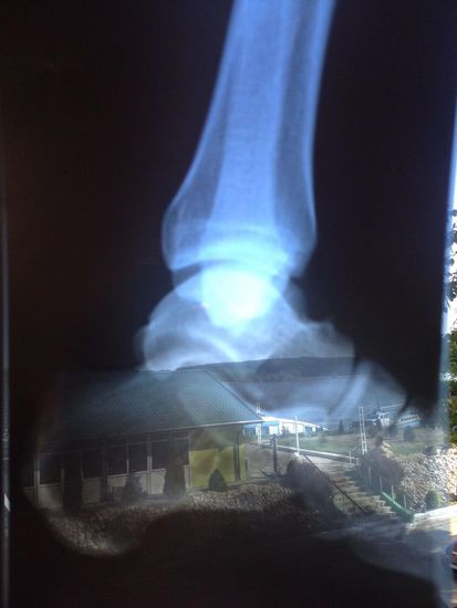 Hier das Röntgenbild mit der Diagnose, das ab morgen unserem Trip nichts mehr im Wege steht... Hurra, unser Norbert ist wieder einsatzfähig. Die Silhouette ist unser Hotel mit direktem Blick auf den Nebenarm der Donau.