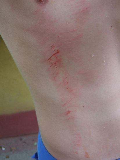 ..aber das dafuer..und ja es tat weh!