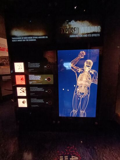 Welches Geschoss erzeugt welche Verletzung, nicht schön, aber real