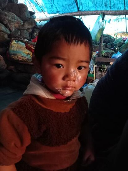 Wir haben Wundsalbe und Pflaster dabei. So werden die Zwei gleich versorgt. Der Anblick ist schwer zu ertragen und geht uns unfassbar nah.