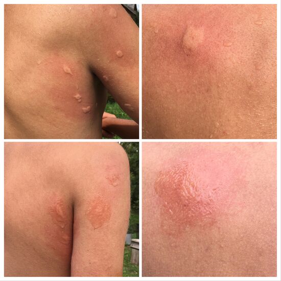 obere Bilder vorher, untere nachher ... 