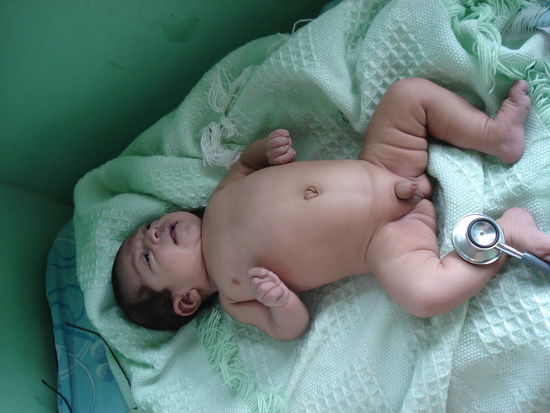 Und ein paar erschreckende Bilder: Hier fehlende Entwicklung der Hoden