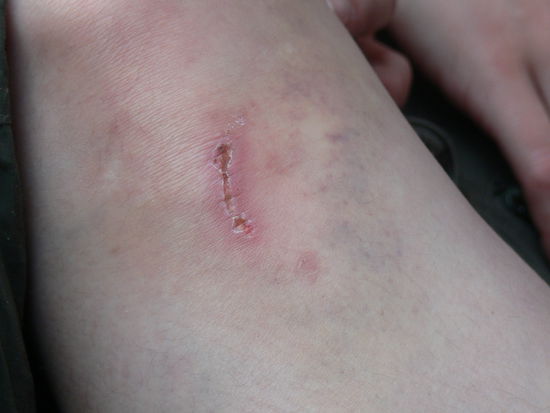 Sieht doch schon wieder ganz gut aus.