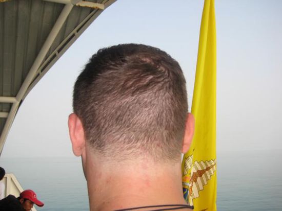 Am weissen Rand sieht man wo vor dem Einheitsschnitt noch Haare waren
