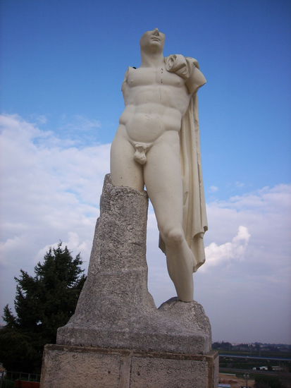 die etwas andere Definition eines Gipsbeines