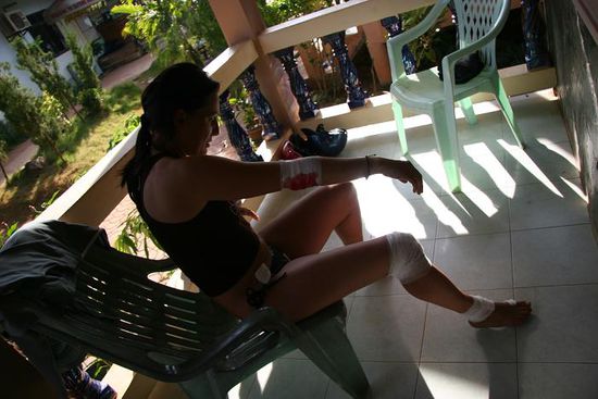 Motorbike Accident - nach der Erstversorgung