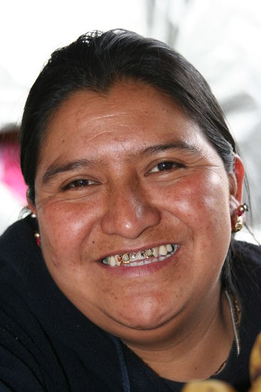 Seht Ihr die 2 kleinen Sternlein auf den Zähnen ?