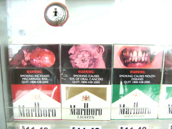 So wird hier auf die Gefahren des Rauchens aufmerksam gemacht... (es gibt noch viel mehr solcher grauslicher Bilder auf den Zigarettenpackerln!)