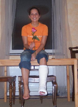 Und so sieht eine harmlose Korallenverletzung nach 10 Wochen aus! Zwei weitere OP's in Deutschland und drei Wochen Gips! Versucht nie Korallen zu schmuggeln, sie erwischen auch euch!