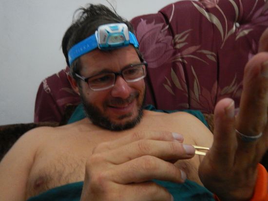 Michael operiert die Dornen aus den Händen