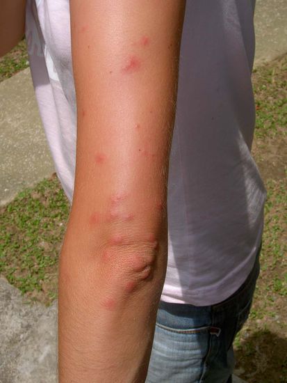 Tatjana hatte in der 2ten Nacht auf Tioman keinen Spass mit unseren Logiergaesten den roten Ameisen