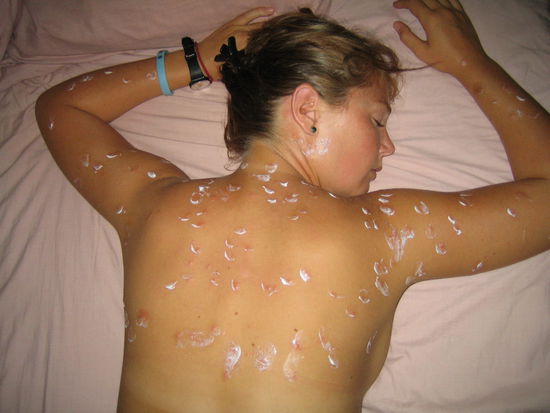 Diesmal hatten die Sandfliegen Fabienne als Opfer ausgewaehlt. Im Gegensatz zu mir reagierte sie viel heftiger und konnte in der Nacht kaum schlafen (ich auch nicht)da es immer gejuckt hat.