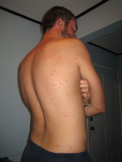 Wenn Sandfliegen Beute finden......