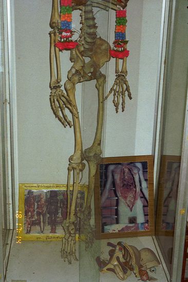 Hier wird über Eingeweiden meditiert, eine wirksame Methode, seine Begierde in den Griff zu kriegen.