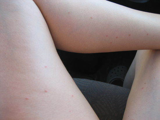 Stiche am ganzen Körper....