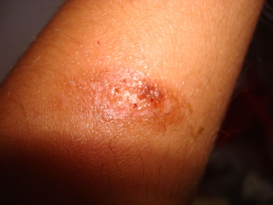 mein ganz persönliches Brandzeichen