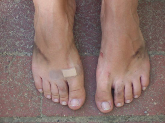 und so sehen dann die Füsse aus