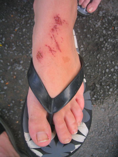 Ist doch nur ein kleiner Kratzer.