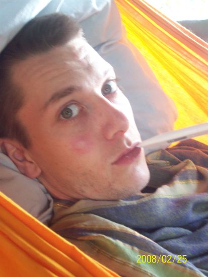 leidender chrisy mit fettem mosquitostich auf der wange