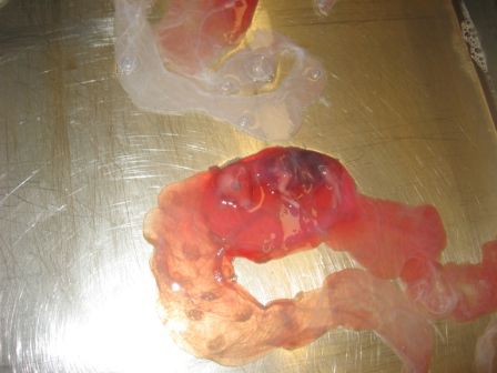 Embryo etwa 100 Tage alt, krass oder! Sonst kenn ich das nur von Bildern.