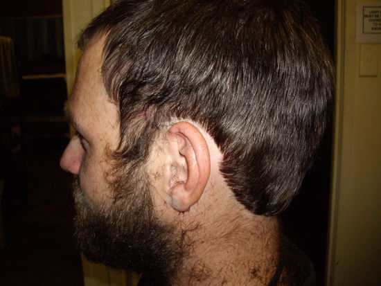 Seitenansicht Haarschnitt