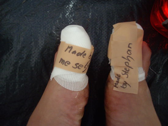 Tja Stephan war meine Krankenschwester und hat meine Zehen verbunden und getaippt