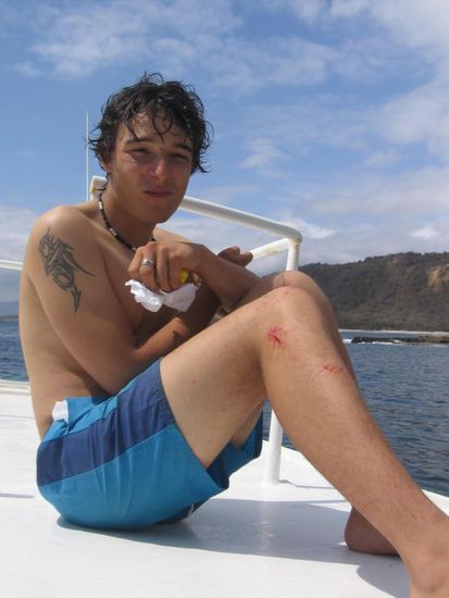 Haiattacke? Oder doch nur aufgeschürft beim Raufklettern aufs Boot?