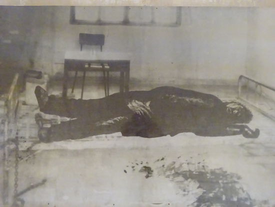 Orginal Fotos von Folteropfern