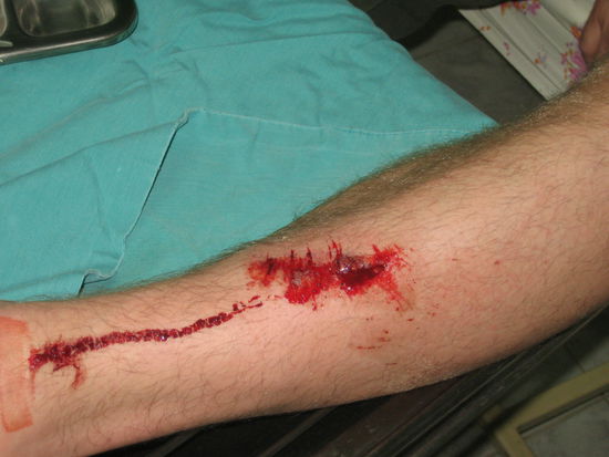 Das vorzeitge Ende der Reise fuer Matze