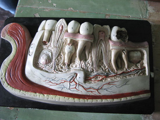 Volda - ...Zahnaufbau bis hin zur Karies... recht eindrücklich!