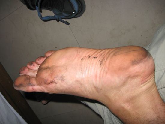 die Fuesse werden in Kolkata beim Rumlaufen nicht nur muede, sondern vor allem auch dreckig