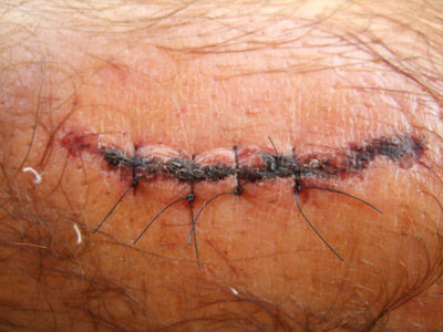 Dont drink and dive!