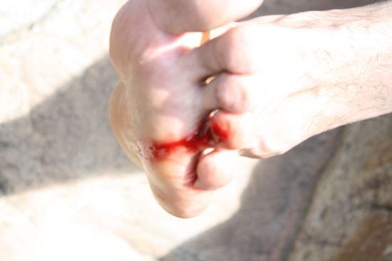 armins litsch (blutegel)