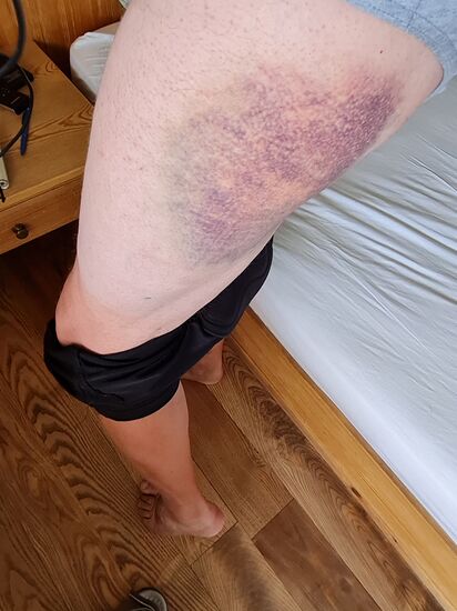 Unschön, konnte aber letztendlich den Beginn der Mainradtour nicht stoppen !