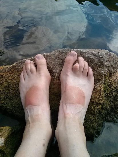 Die Wassertemperatur des Mains mal kurzfristig um einige °C-Bruchteile angehoben. Die charakteristische Fußfärbung, bedingt durch die Öffnungen 
meiner Radl-Sandalen, die ich von Anfang bis Ende der Tour an den Füßen hatte - nur am ersten Tag mit Sneaker-Socken - sieht zwar dramatisch aus, 
war aber mittels genügend Sonnencreme ohne schmerzende Begleiterscheinung. Das Muster wird sich noch einige Zeit als Erinnerung halten.