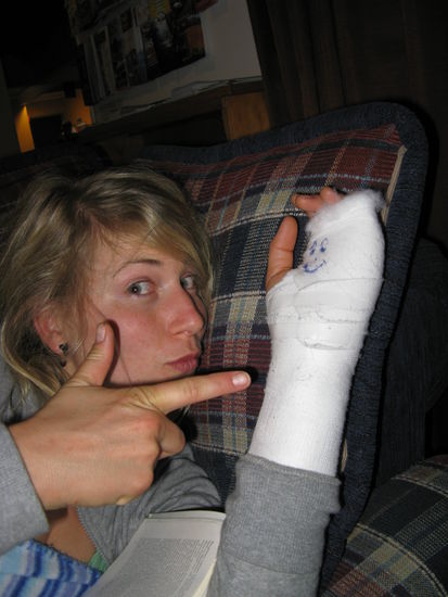 Ein etwas skeptischer Blick, aber der gebrochene Finger waechst wieder zusammen.