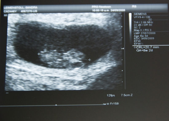 Wally auf Reisen, hier in Wellington.